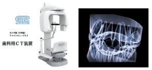 歯科用CTの画像